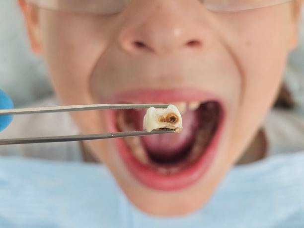 Best Walk-In Emergency Dentist in Royal Oak, MI
