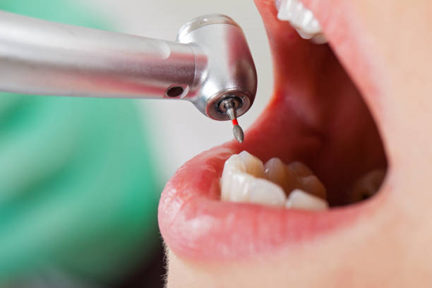 Best Same-Day Emergency Dentist in Royal Oak, MI